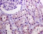 Anti-Phospho-Akt (Ser473) AKT1 Rabbit Monoclonal Antibody